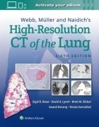 Webb, Müller and Naidich's High-Resolution CT of the Lung, 6/e