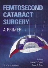 Femtosecond Cataract Surgery: A Primer 