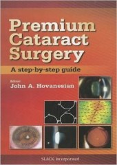 Premium Cataract Surgery: A Step-by-Step Guide 
