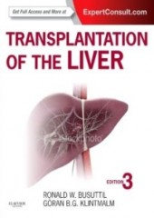 Transplantation of The Liver, 3/e