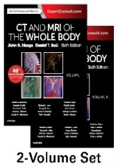CT and MRI of the Whole Body, 6/e (2-Volume Set)