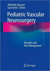 Pediatric Vascular Neurosurgery: Disorders and their Management