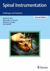 Spinal Instrumentation: Challenges and Solutions, 2/e