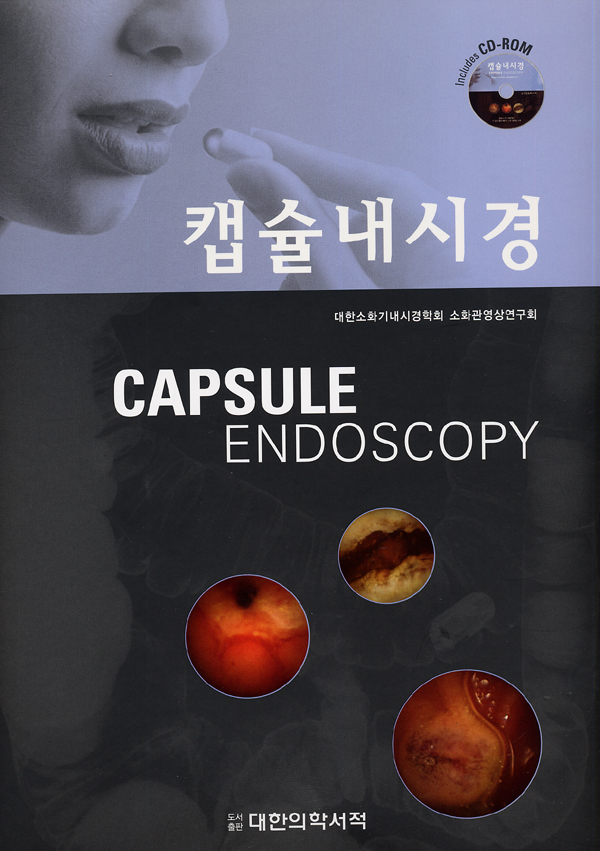 캡슐내시경 - CAPSULE ENDOSCOPY