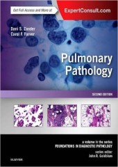 Pulmonary Pathology: A Volume in the Series: Foundations in Diagnostic Pathology, 2/e