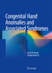 Congenital Hand Differences and Associated Syndromes