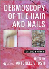 Dermoscopy of the Hair and Nails, 2/e