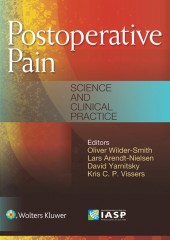 Postoperative Pain: Science and Clinical Practice