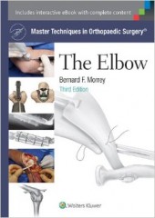 Master Techniques in Orthopaedic Surgery: The Elbow, 3/e