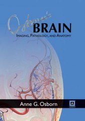 Osborn's Brain: Imaging, Pathology, and Anatomy: Published by Amirsys 