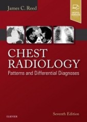 Chest Radiology, 7/e