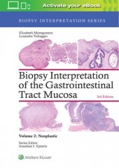 Biopsy Interpretation of the Gastrointestinal Tract Mucosa: Volume 2: Neoplastic, 3/e