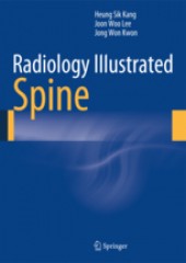 Radiology Illustrated:Spine