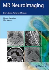 MR Neuroimaging: Brain, Spine, and Peripheral Nerves
