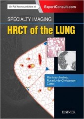 Specialty Imaging: HRCT of the Lung, 2/e