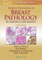 Rosen's Diagnosis of Breast Pathology by Needle Core Biopsy, 4/e
