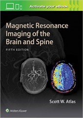 Magnetic Resonance Imaging of the Brain and Spine , 5/e 