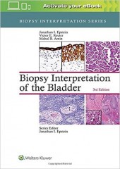 Biopsy Interpretation of the Bladder , 3/e