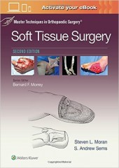 Master Techniques in Orthopaedic Surgery: Soft Tissue Surgery, 2/e 