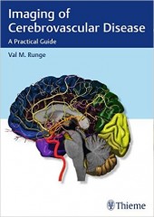 Imaging of Cerebrovascular Disease: A Practical Guide