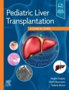 Pediatric Liver Transplantation, 1st Edition