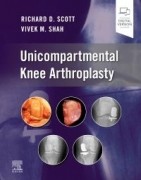 Unicompartmental Knee Arthroplasty, 1st Edition