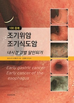 100 증례 조기위암 조기식도암-내시경 감별 달인되기
