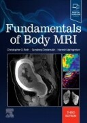 Fundamentals of Body MRI, 3rd Edition