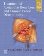 Treatment of Acetabular Bone Loss and Chronic Pelvic Discontinuity, 1st Edition
