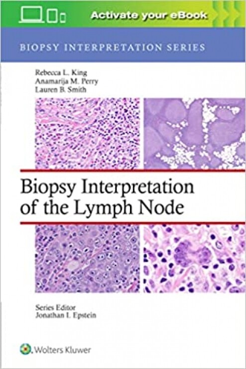 Biopsy Interpretation of the Lymph Nodes (Biopsy Interpretation Series) First Edition