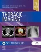 Thoracic Imaging: Case Review, 3rd Edition