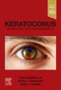 Keratoconus, 1st Edition Diagnosis and Management