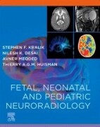 Fetal, Neonatal and Pediatric Neuroradiology, 1st Edition