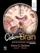Osborn's Brain, 3rd Edition