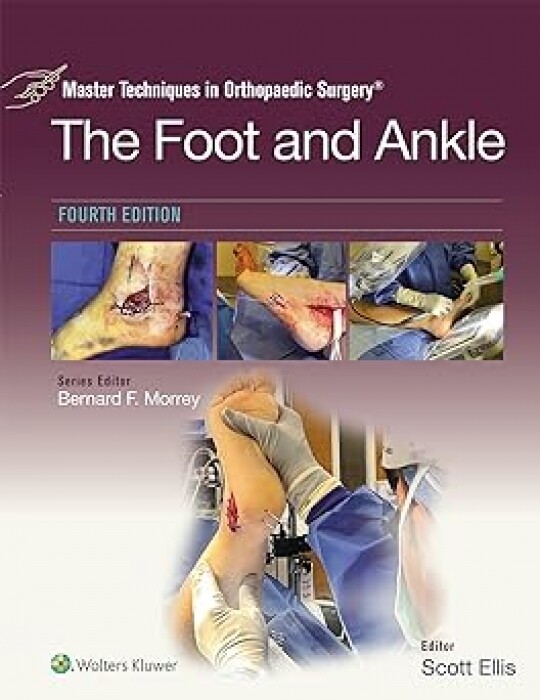Master Techniques in Orthopaedic Surgery: The Foot and Ankle 4/e