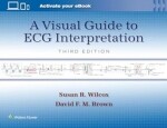 A Visual Guide to ECG Interpretation 3/e