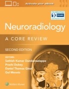 Neuroradiology: A Core Review 2/e