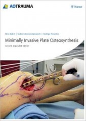 Minimally Invasive Plate Osteosynthesis (MIPO), 2/e