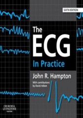 The ECG In Practice, 6/e