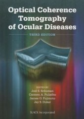 Optical Coherence Tomography of Ocular Diseases, 3/e