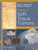 Imaging of Soft Tissue Tumors, 3/e