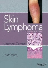 Skin Lymphoma: The Illustrated Guide, 4/e
