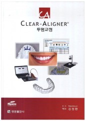 Clear-Aligner 투명교정