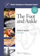 Master Techniques in Orthopaedic Surgery: The Foot and Ankle, 3/e