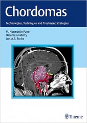 Chordomas: Technologies, Techniques, and Treatment Strategies