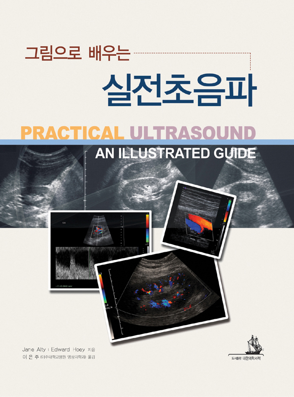 실전초음파 - 그림으로 배우는 Practical Ultrasound : An Illustrated Guide