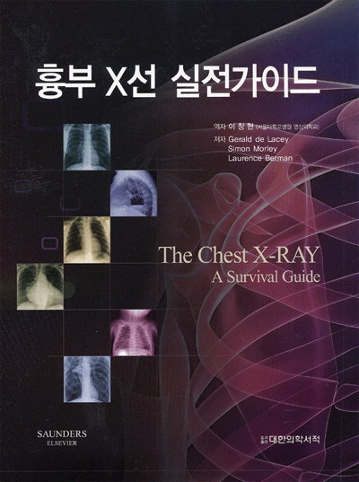 흉부 X선 실전가이드 - The Chest X-Ray : A survival guide