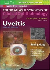 Uveitis (Color Atlas and Synopsis of Clinical Ophthalmology), 2/e