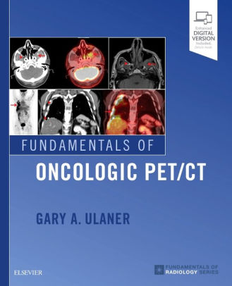 Fundamentals of Oncologic PET/CT, 1/e (Fundamentals of Radiology)