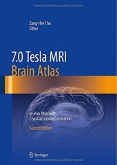7.0 Tesla MRI Brain Atlas: In-vivo Atlas With Cryomacrotome Correlation,2/e